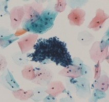 세포1 세포1