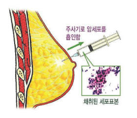 세포3 세포3