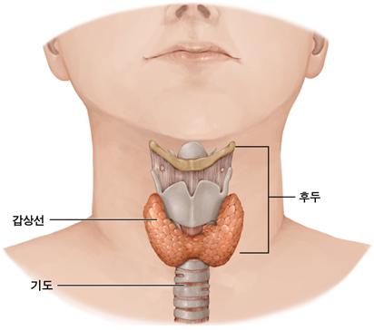 갑상선1 갑상선1
