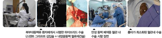 혈액이식외과1 혈액이식외과1