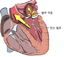 혈액 역류, 정상혈류